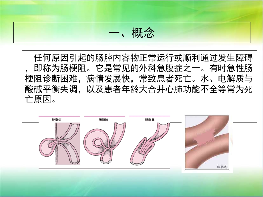 肠梗阻护理常规.ppt_第2页