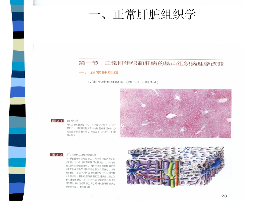 肝癌与肝炎关系.ppt_第3页