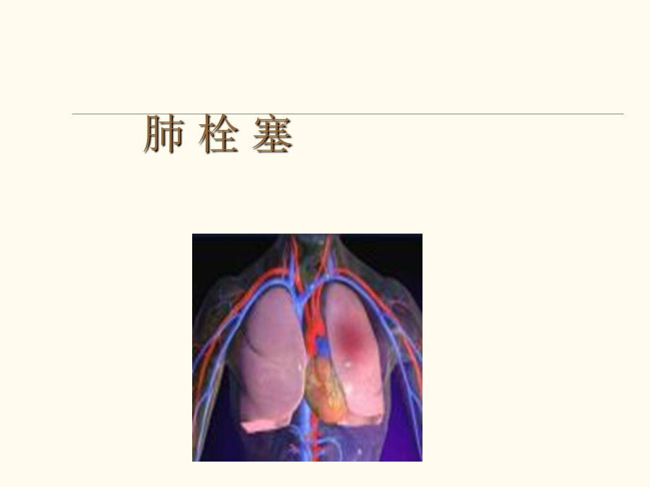 肺栓塞影像表现.ppt_第1页