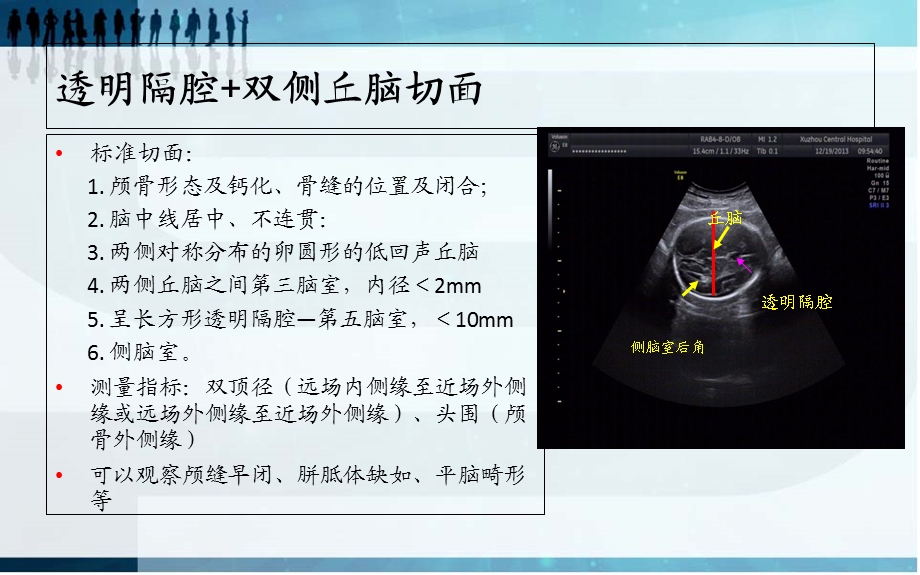 胎儿三维超声筛查标准.ppt_第2页