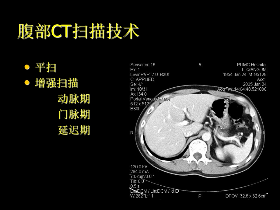 腹部CT正常解剖.ppt_第3页