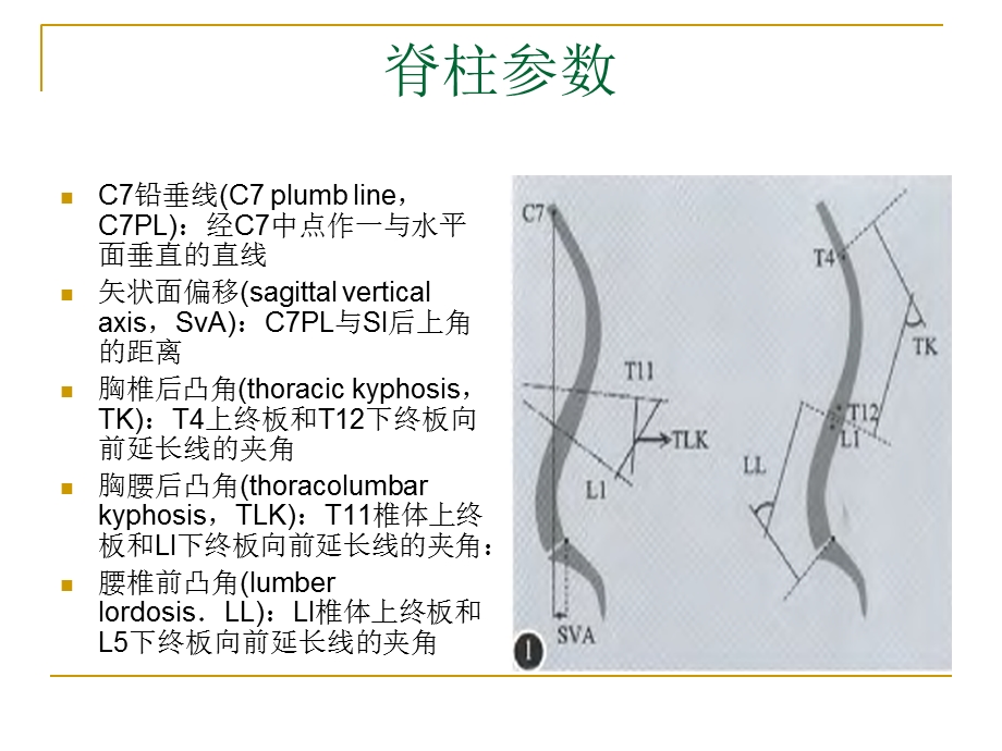 脊柱矢状面平衡.ppt_第2页