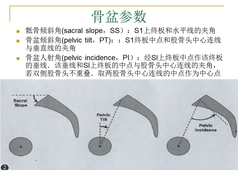 脊柱矢状面平衡.ppt_第3页