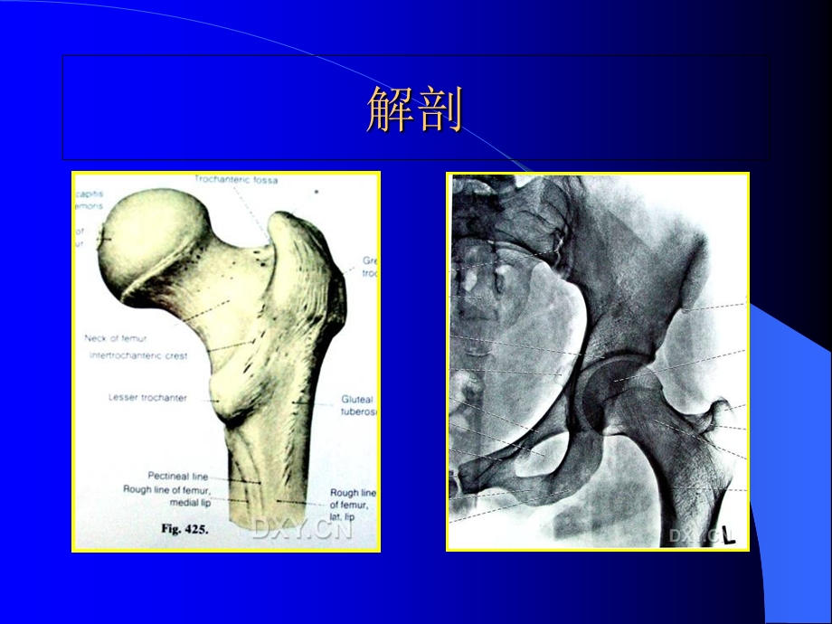 股骨转子间骨折(定稿).ppt_第3页