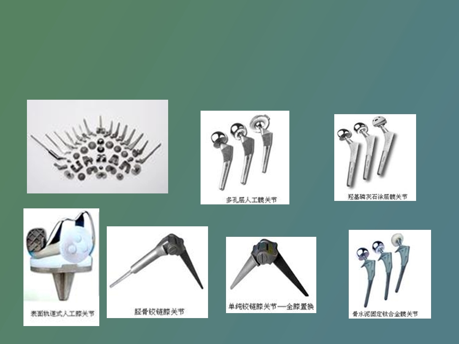 关节置换术的评定.ppt_第3页