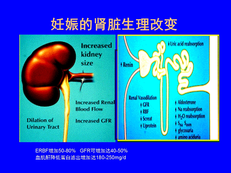妊娠相关急性肾损伤.ppt_第3页