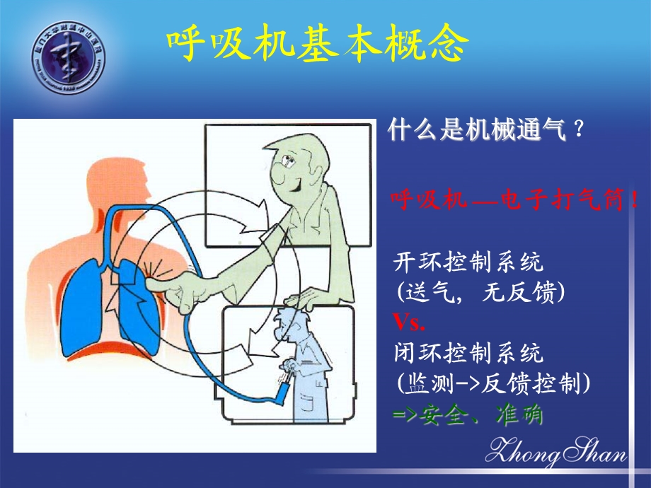 呼吸窘迫综合症.ppt_第2页