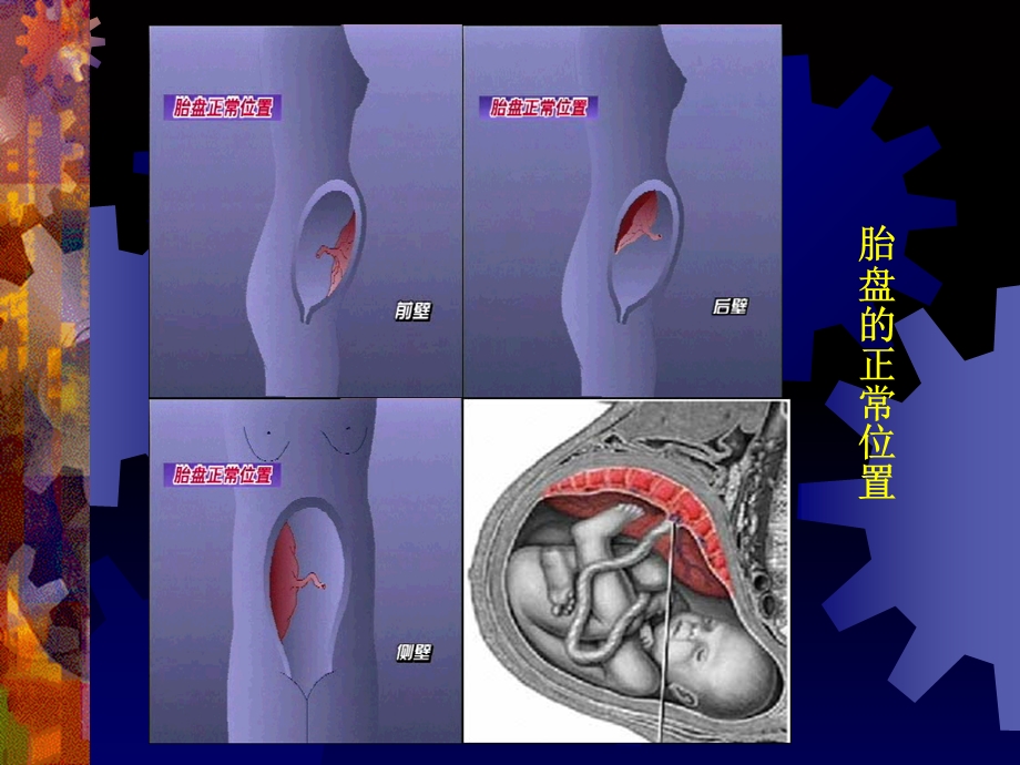 妇产科学精品课件-前置胎盘.ppt_第2页