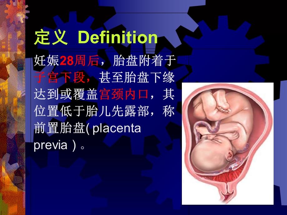 妇产科学精品课件-前置胎盘.ppt_第3页