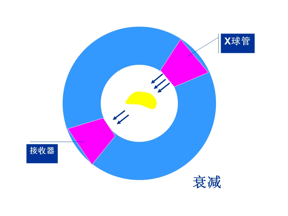 呼吸系统核医学.ppt_第3页