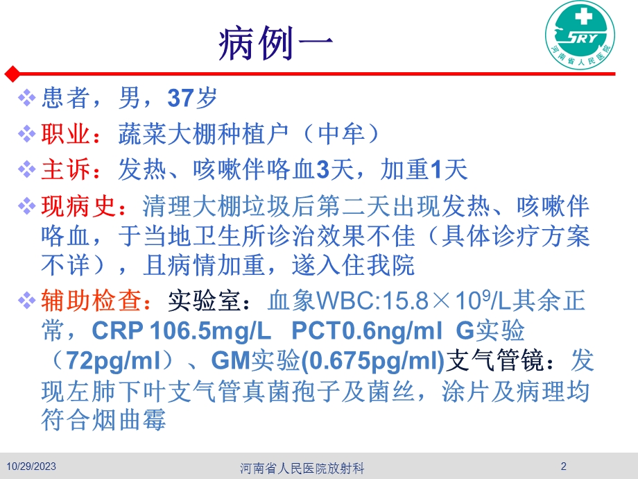 曲霉菌病的诊断ppt课件.ppt_第2页