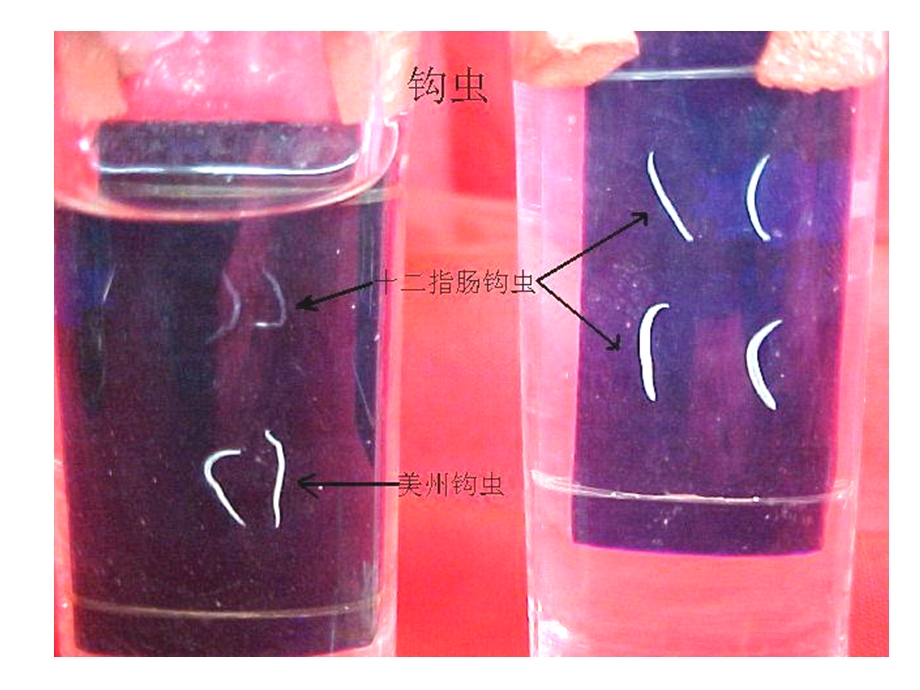 寄生虫实验2蛲钩.ppt_第3页