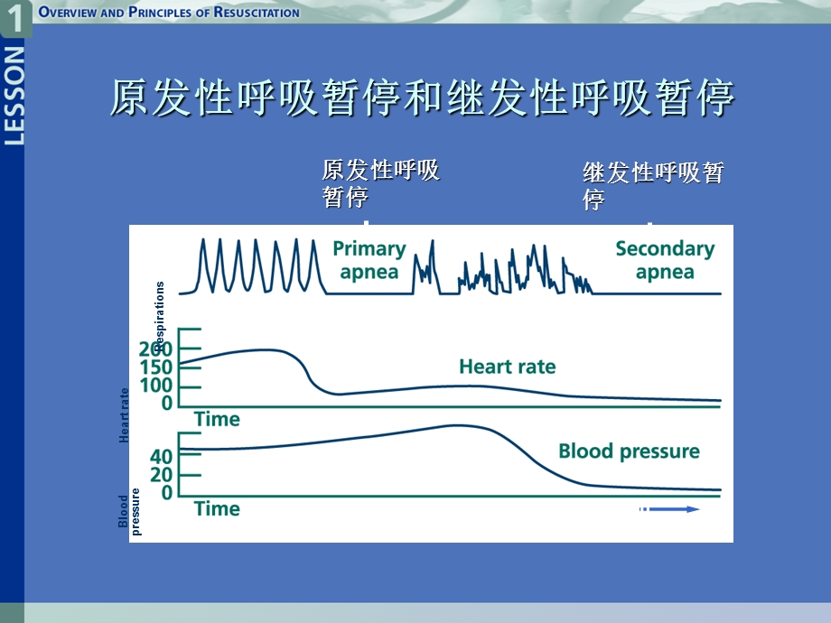 新生儿高胆红素血症新进展.ppt_第3页