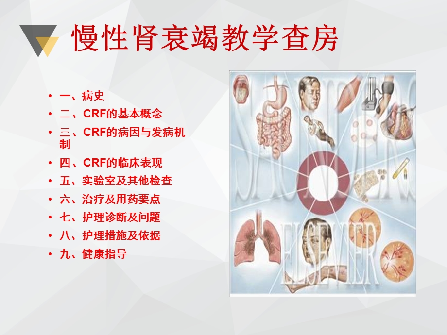 慢性肾衰竭病教学查房ppt课件.ppt_第2页