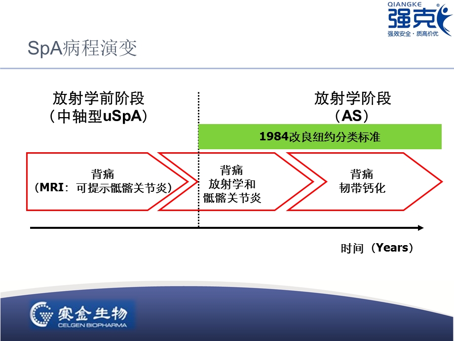 强直性脊柱炎的挑战.ppt_第3页