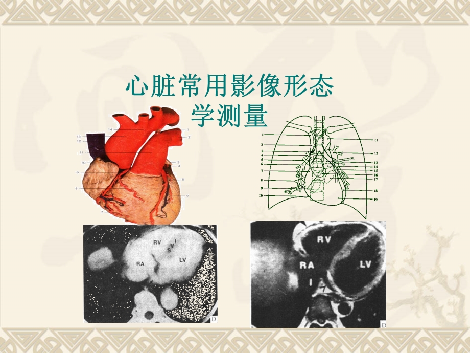 心脏影像形态学测量.ppt_第1页