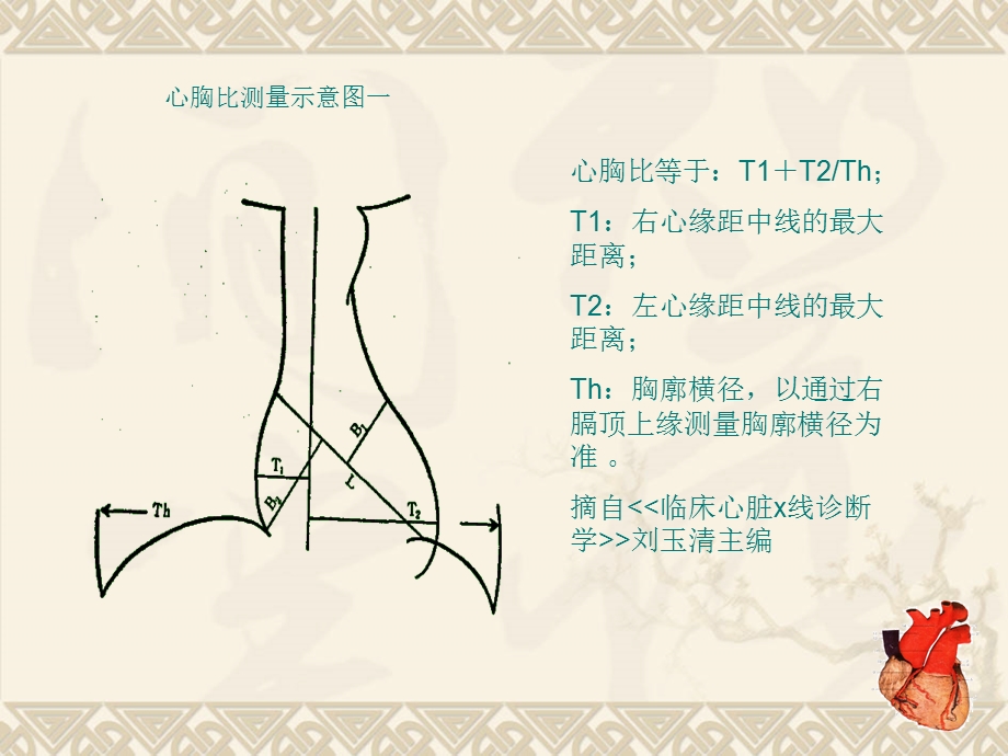 心脏影像形态学测量.ppt_第3页