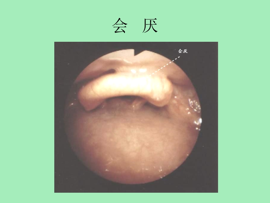 气管镜图谱复.ppt_第1页