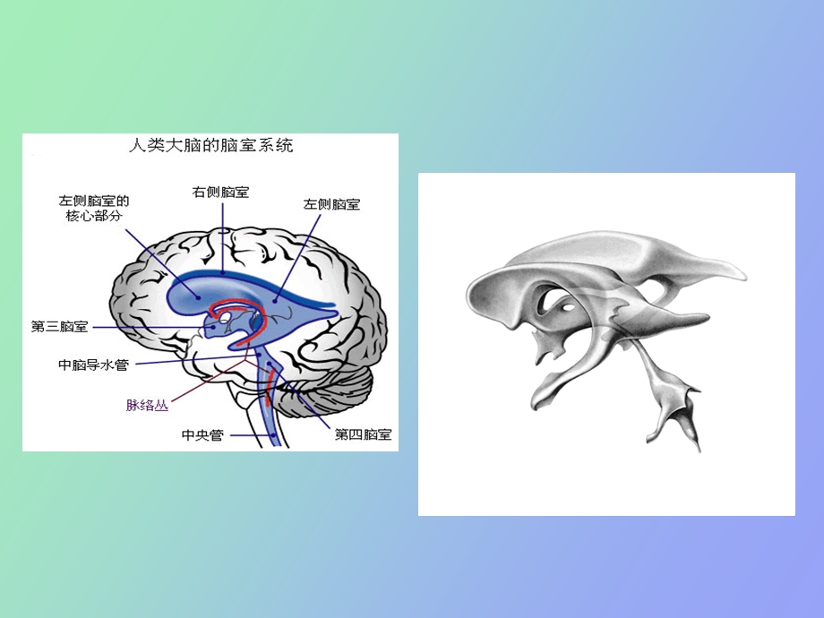 脑室外引流讲.ppt_第3页