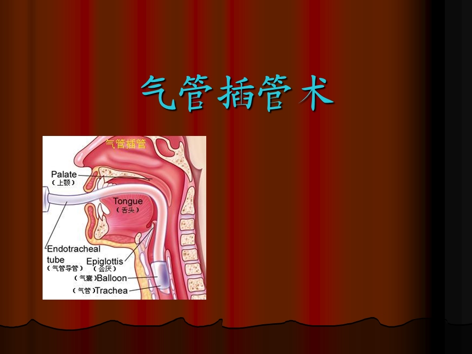 气管插管技术讲课.ppt_第1页