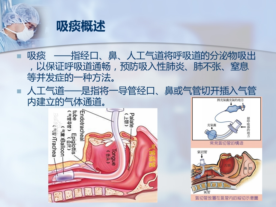 气管插管吸痰术.ppt_第2页