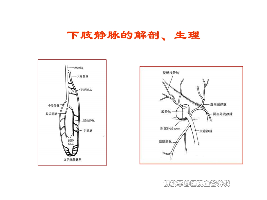 浅谈下肢静脉曲张及其治疗策略课件.ppt_第3页