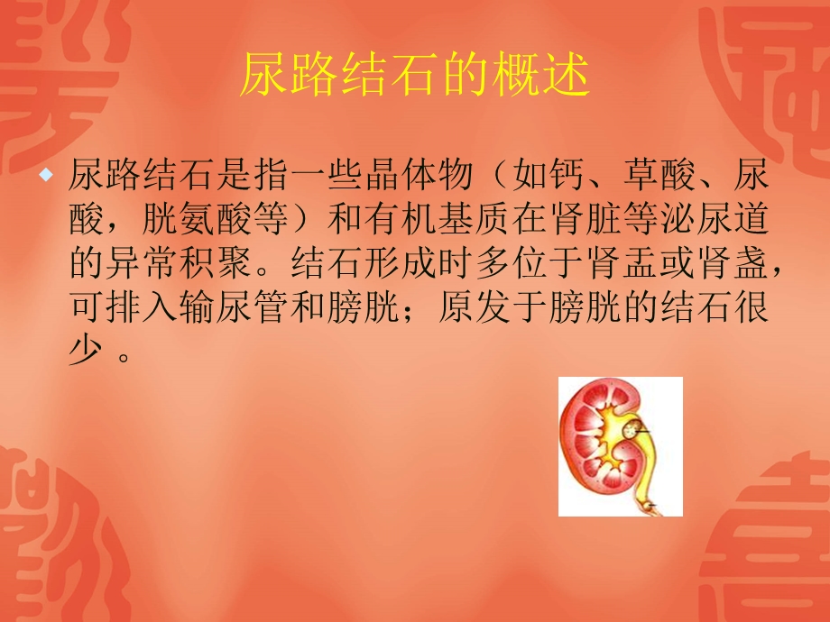 泌尿系统结石的防治.ppt_第2页