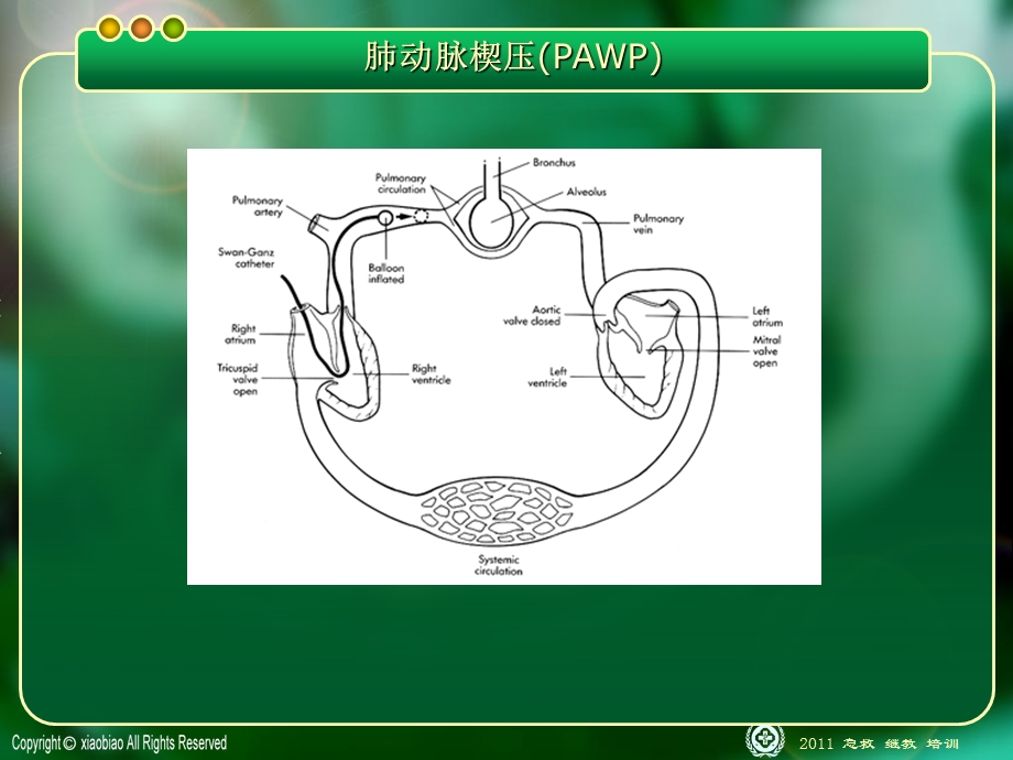 漂浮导管临床应用新进展ppt课件.ppt_第2页