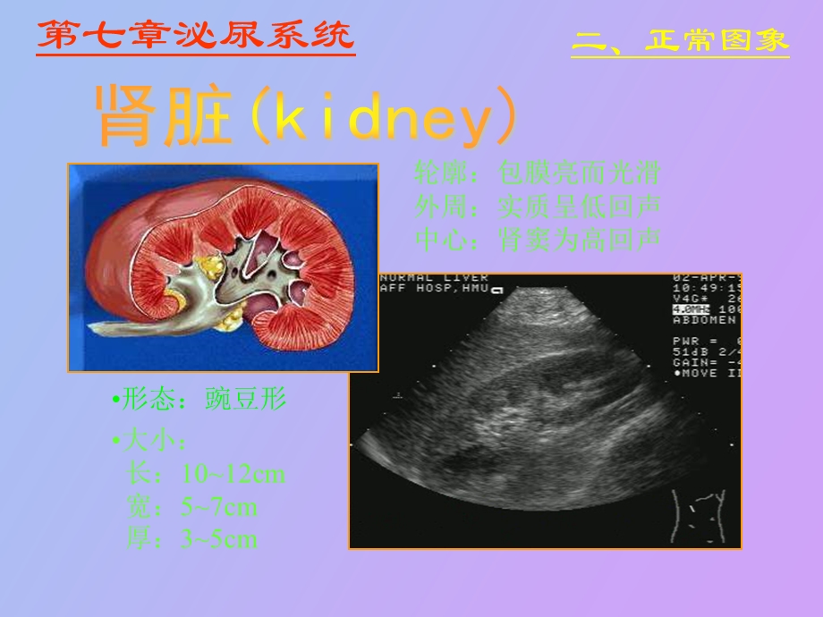 泌尿系统超声.ppt_第3页