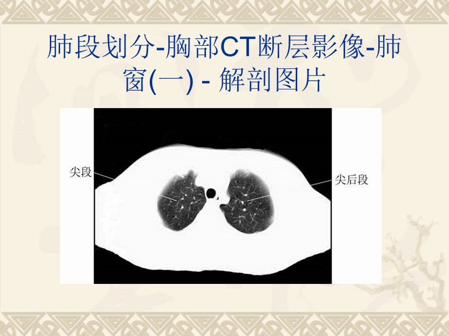 胸上腹部和盆腔CT图谱.ppt_第2页