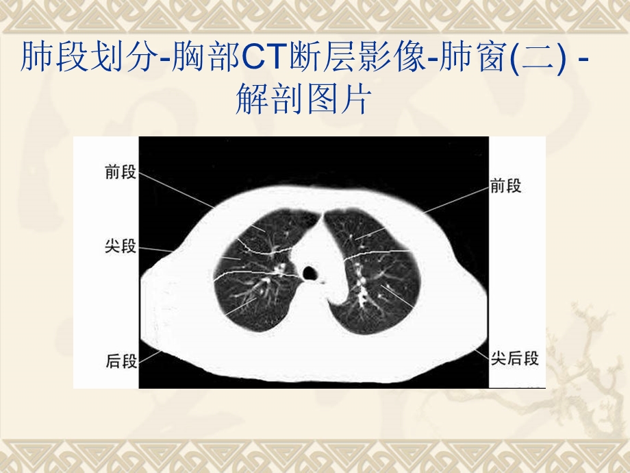 胸上腹部和盆腔CT图谱.ppt_第3页