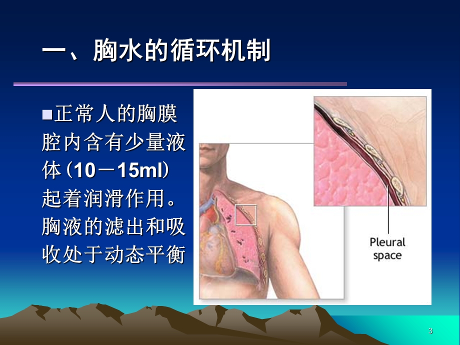 胸腔积液PleuralEffu.ppt_第3页