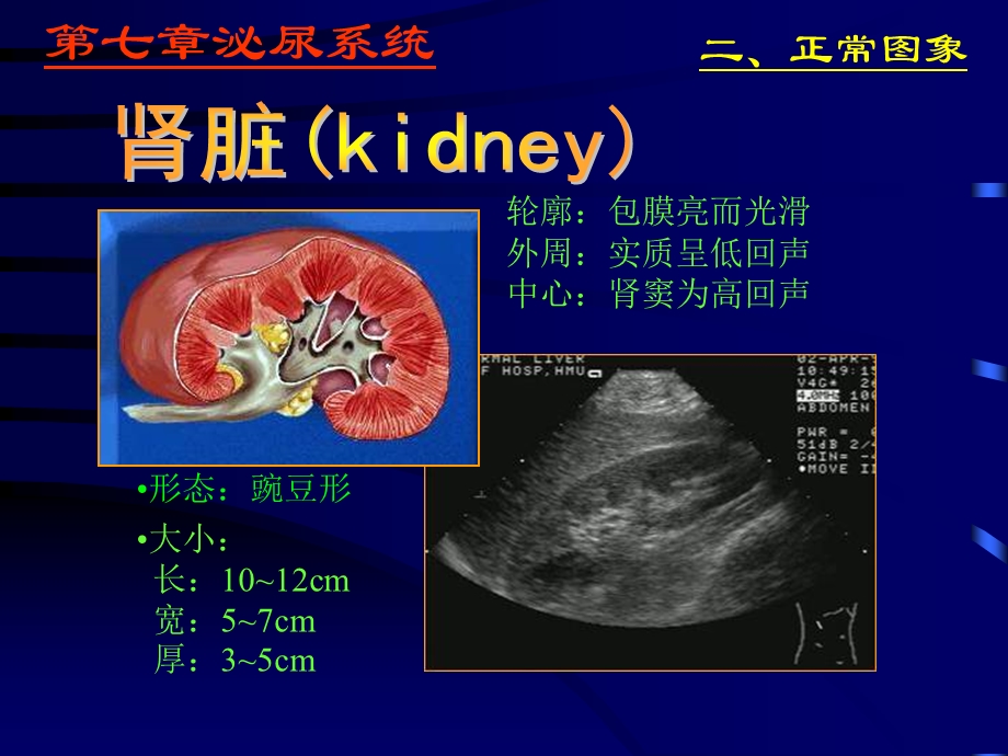 泌尿系统超声学-二正常图象.ppt_第3页