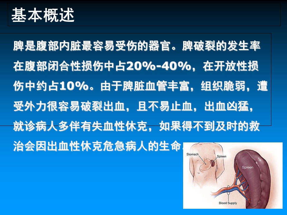 脾破裂的护理.ppt_第3页