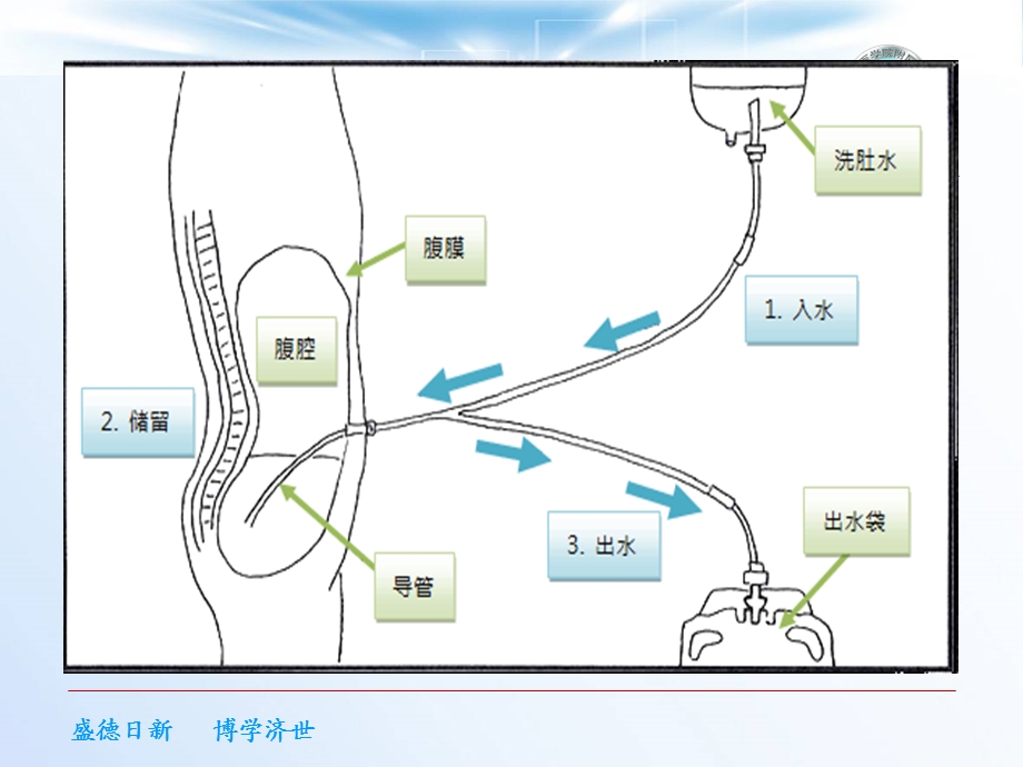 腹膜透析相关护理课件-.ppt_第3页