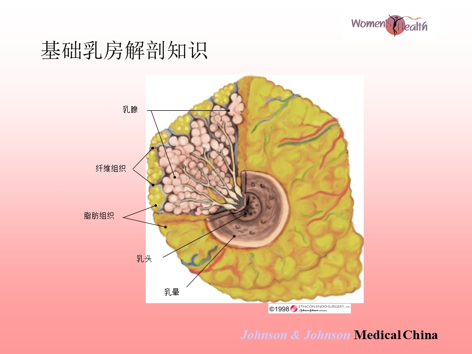 麦默通-微创乳腺活检技术.ppt_第2页