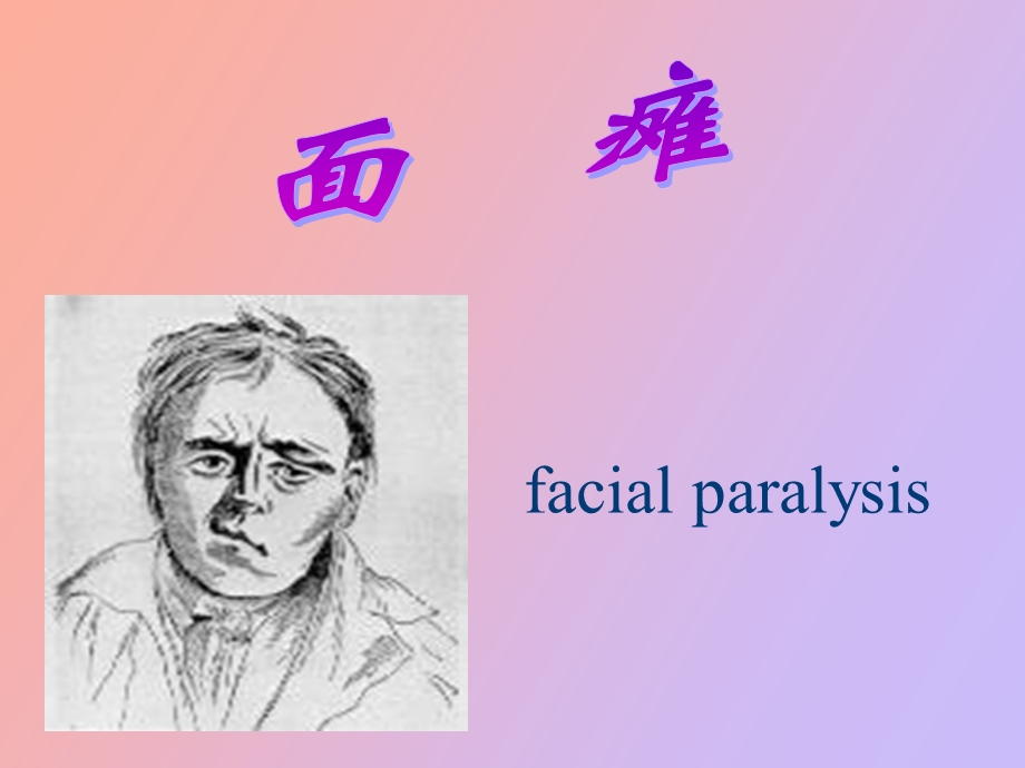 面瘫针灸疗法.ppt_第1页