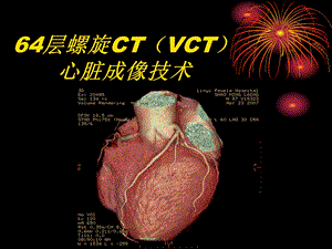 排螺旋CT心脏成像技术.ppt