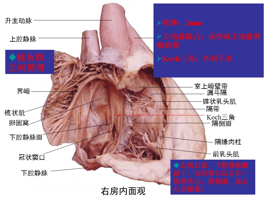 心中有数介入治疗的应用解剖.ppt_第2页