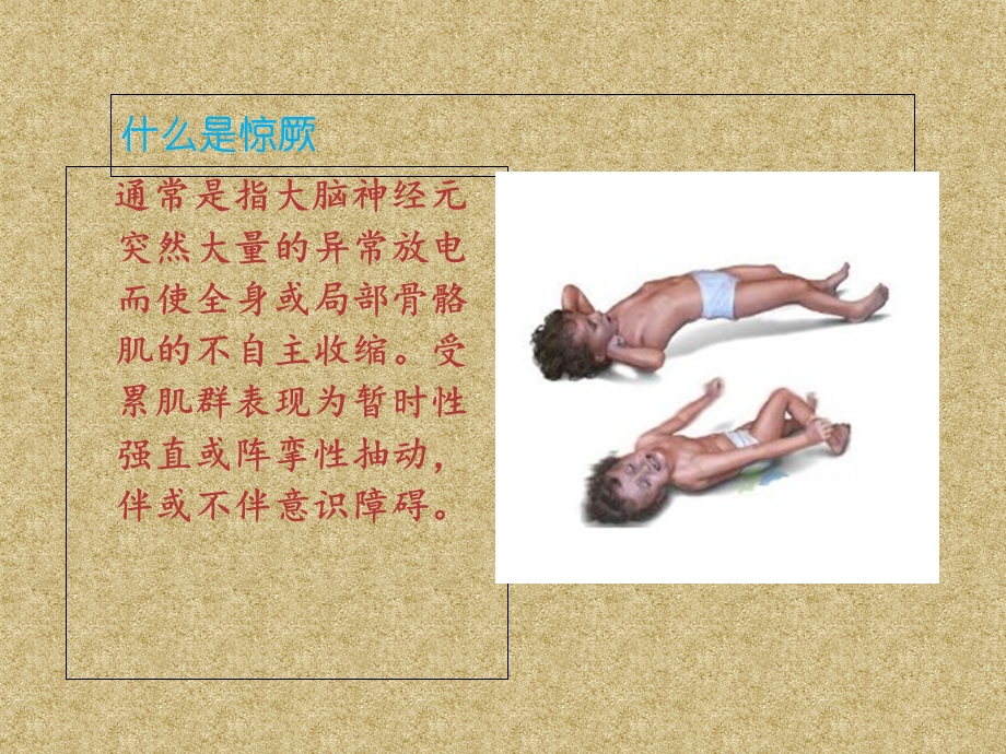 热性惊厥的护理.ppt_第2页