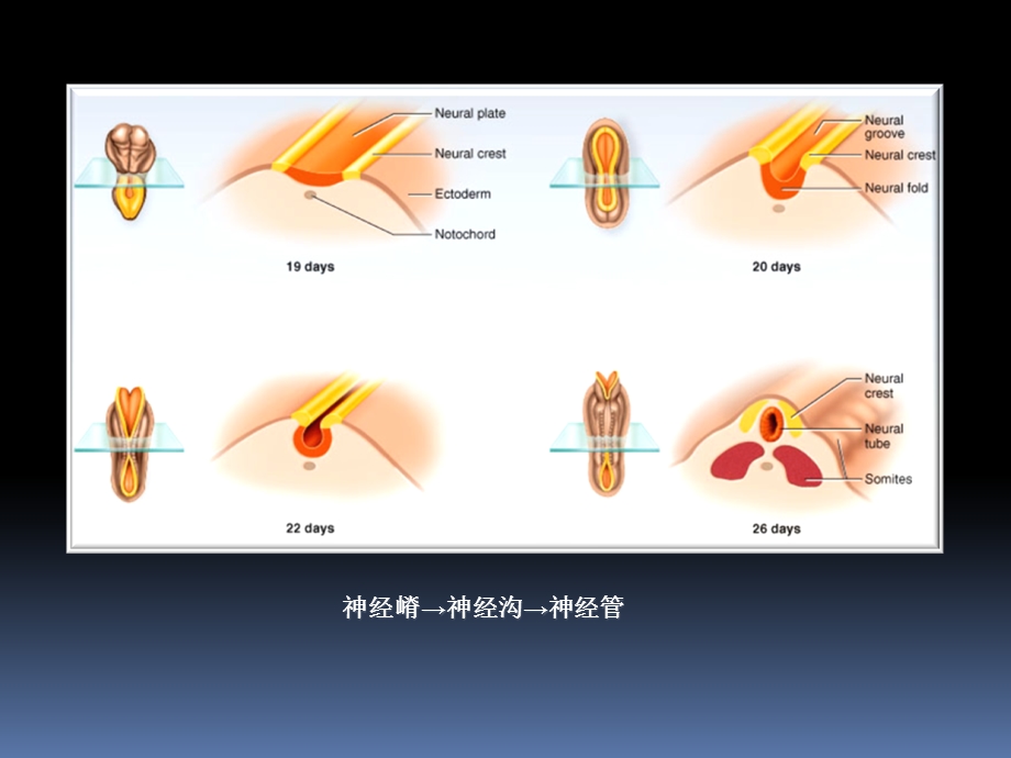 罗英瑾06-06脑干外形.ppt_第2页