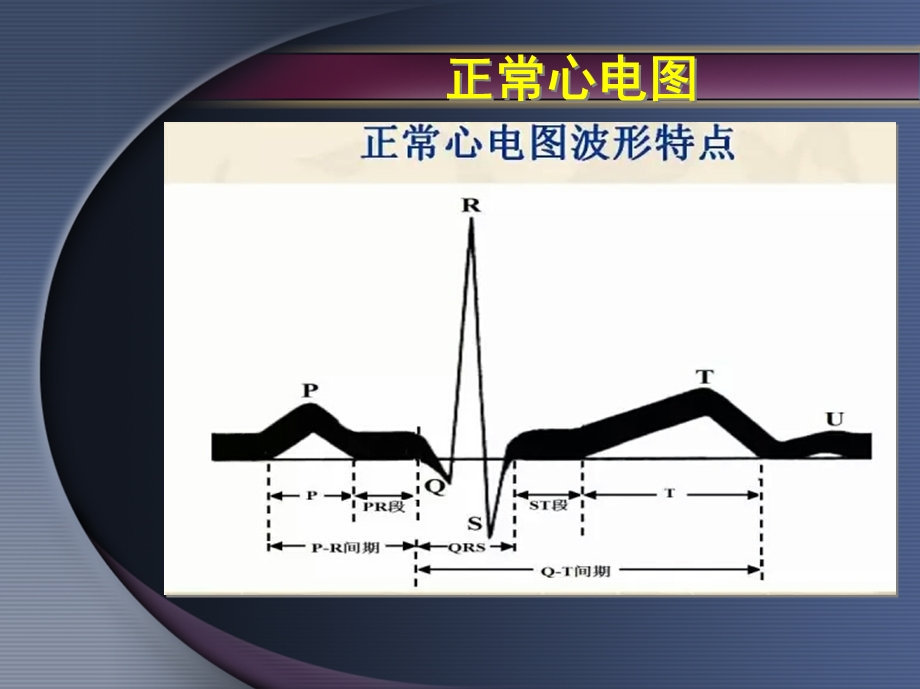 麻醉手术中常见心率失常.ppt_第3页