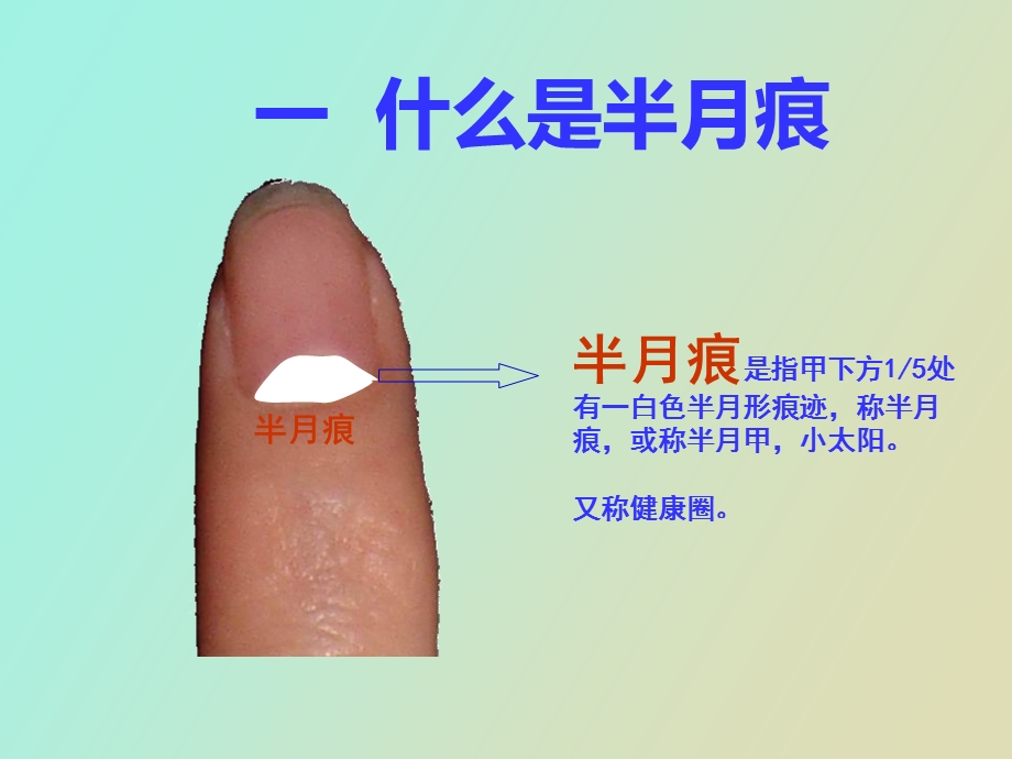 半月痕观健康.ppt_第3页