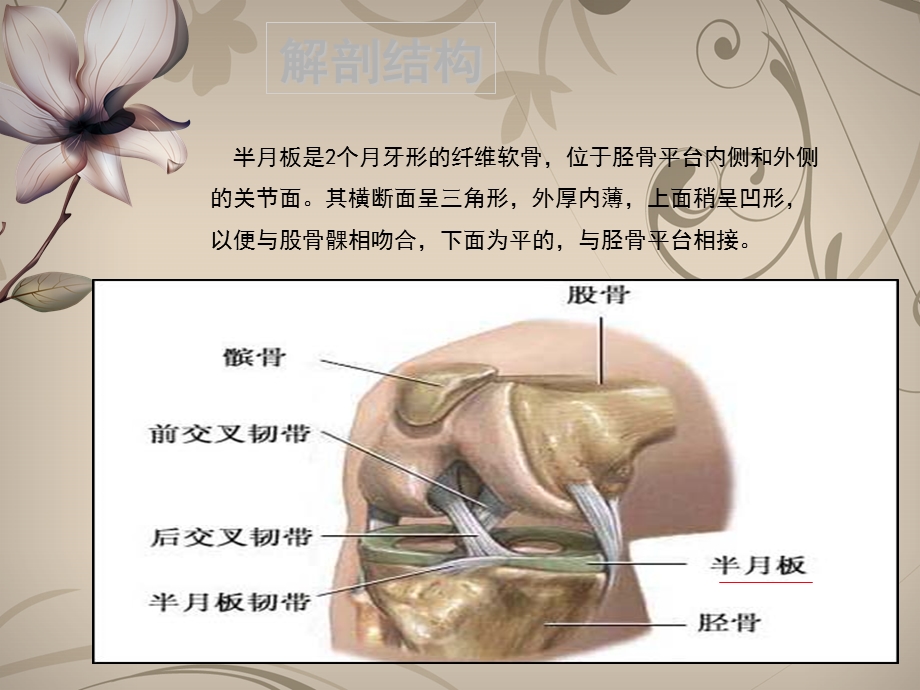 半月板损伤护理ppt课件.ppt_第3页