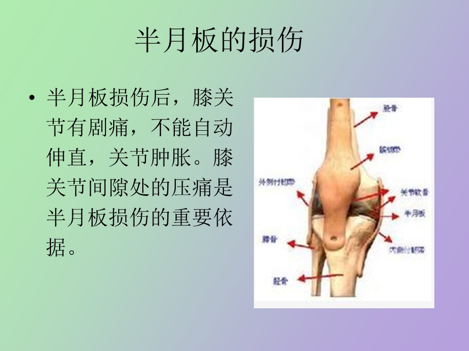 半月板的损伤.ppt_第2页