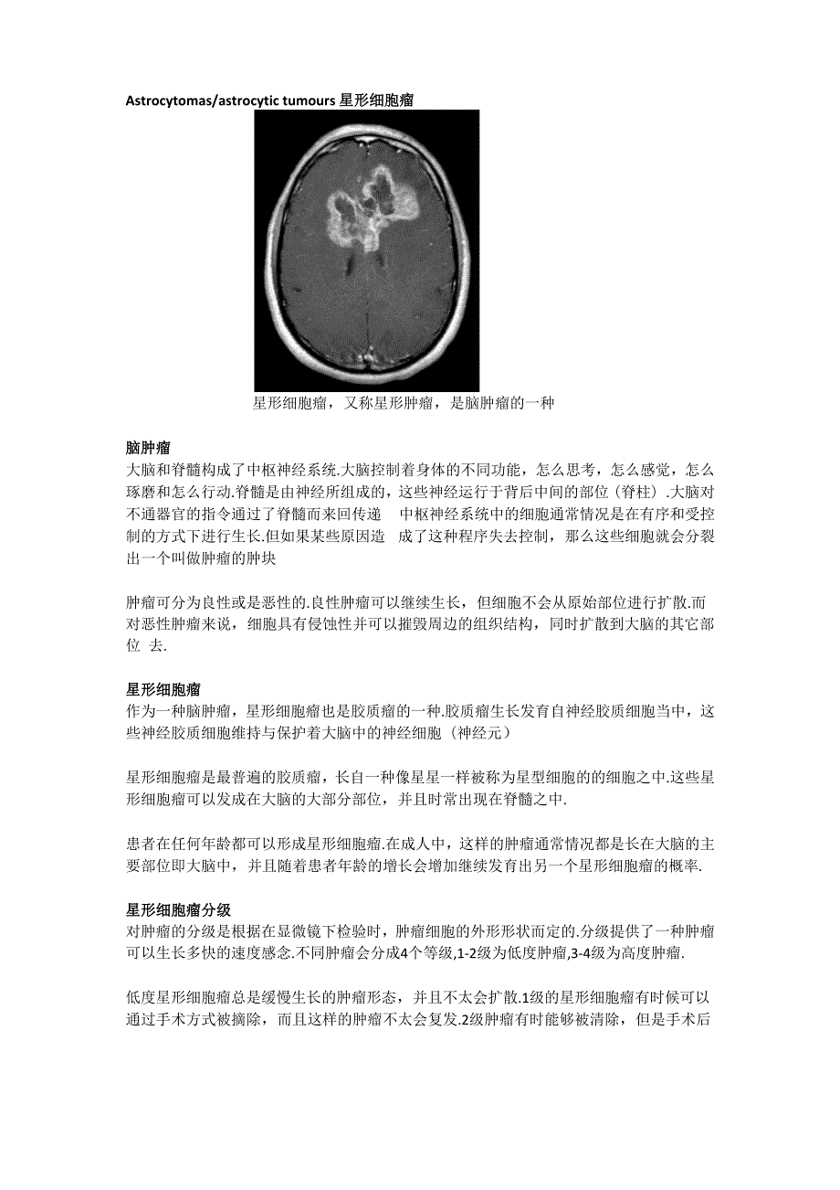 星形细胞瘤质子治疗.docx_第1页