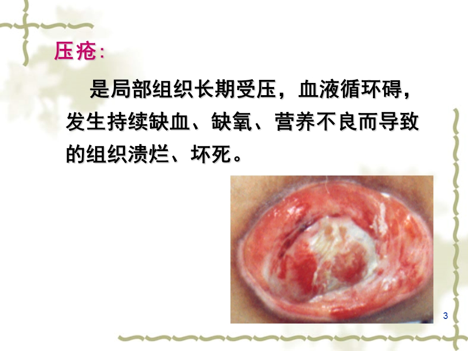 护理学基础病人清洁卫生PPT课件.ppt_第3页