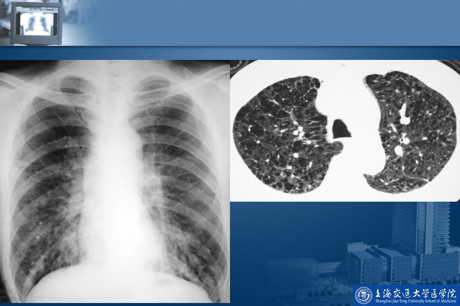 呼吸系统影像学基础.ppt_第3页