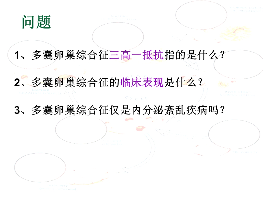 多囊卵巢综合征陶.ppt_第2页