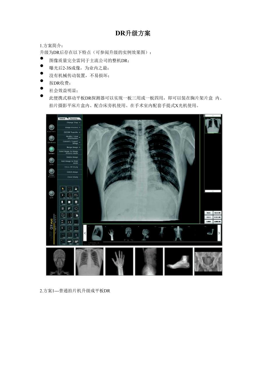 普通床边机升级移动DR方案.docx_第1页